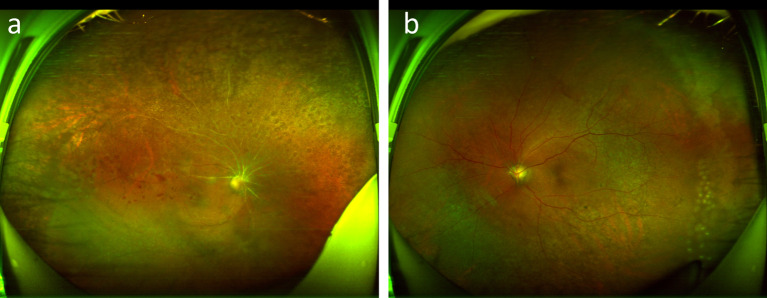 Fig. 9