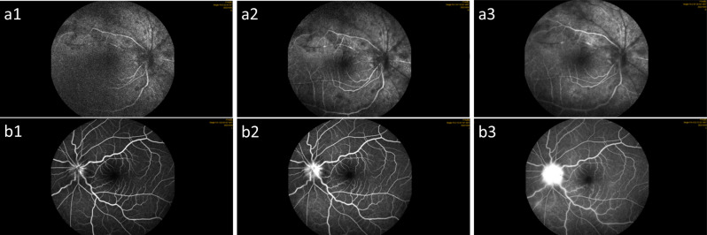 Fig. 5