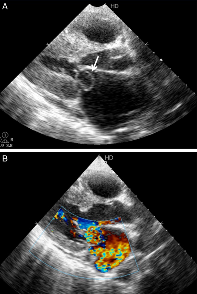 Figure 2