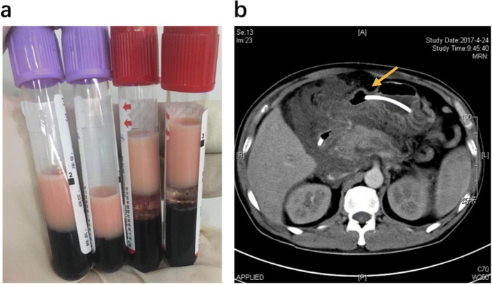 Fig. 2