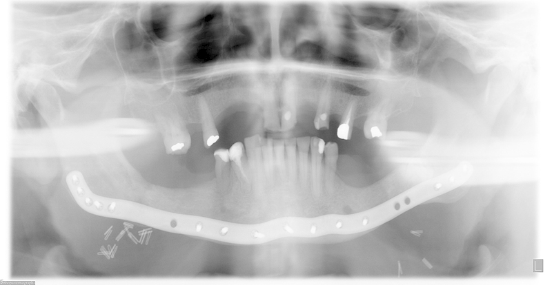 Fig. 12
