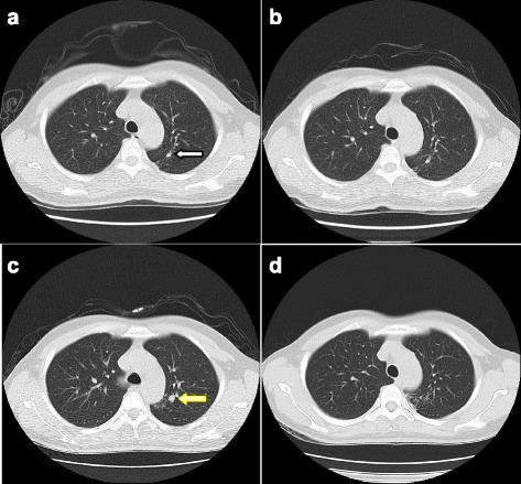 Fig. 2