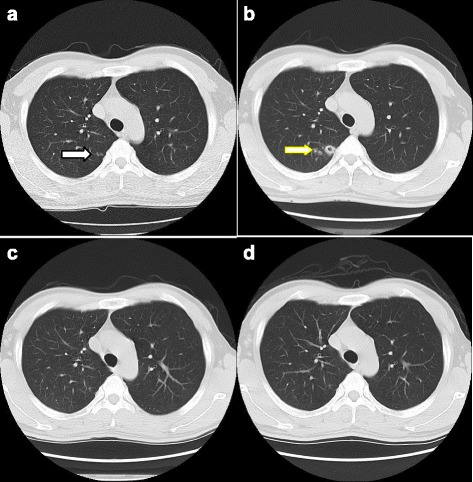 Fig. 4