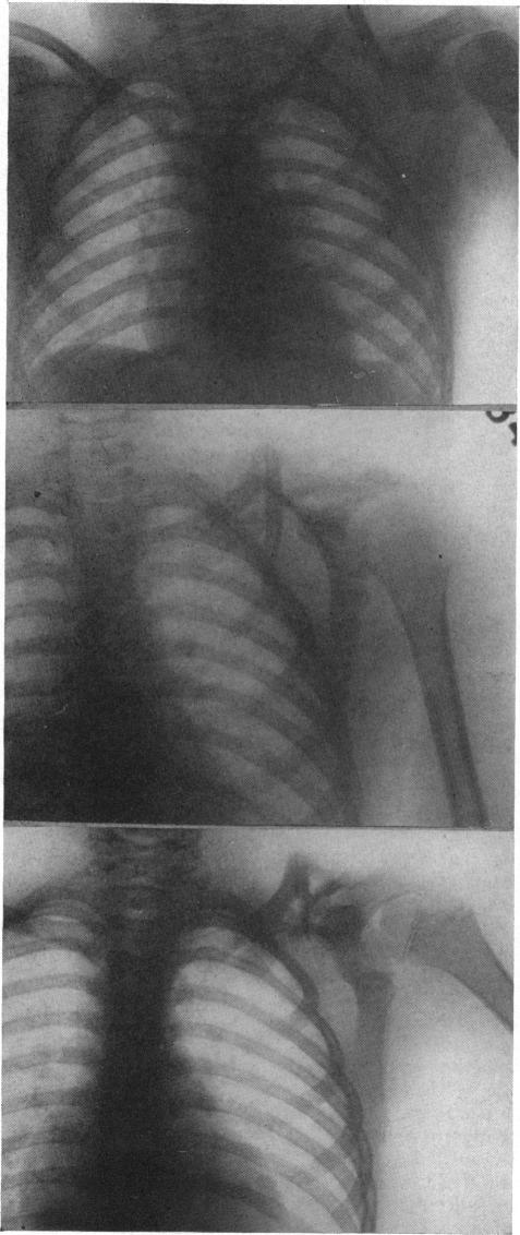 FIG. 1, 2, 3.