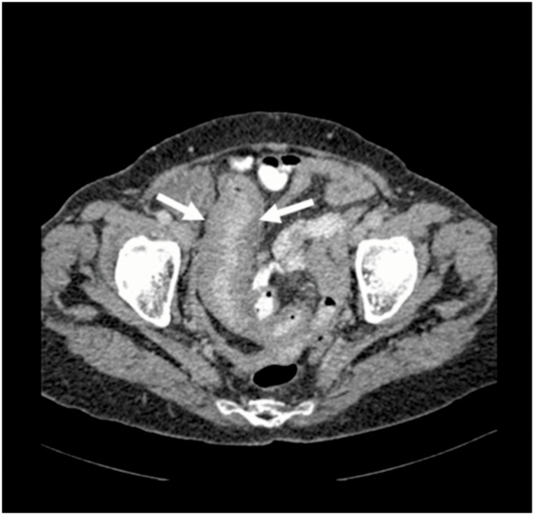 Figure 1b