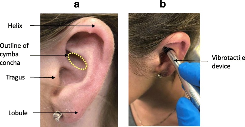 Fig. 1