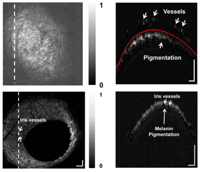 Figure 22