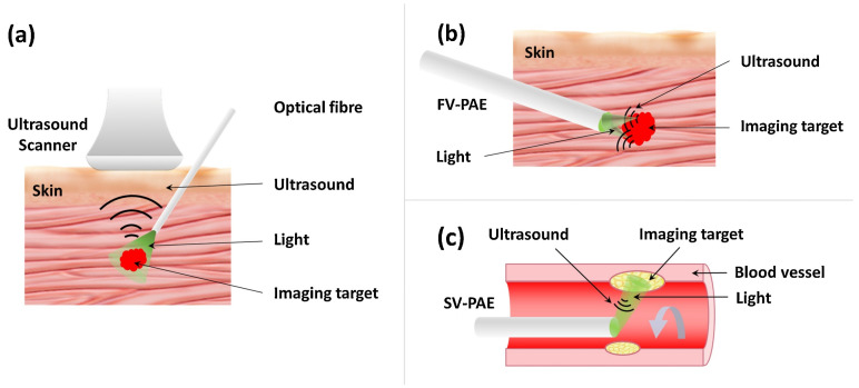 Figure 12