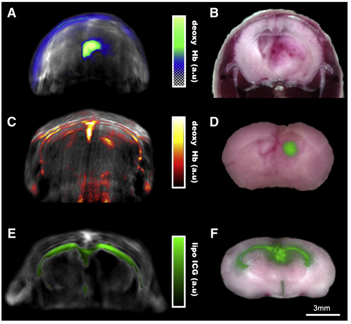 Figure 15