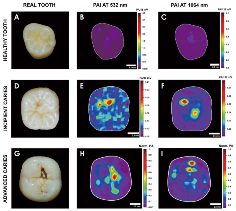 Figure 23