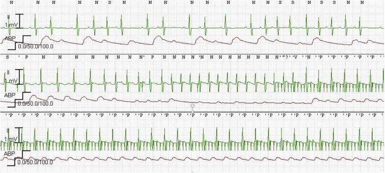Figure 1