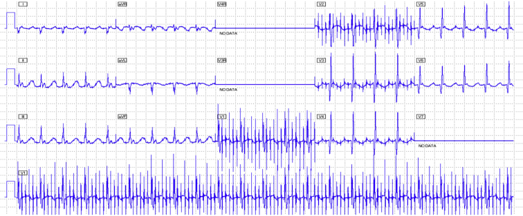 Figure 3