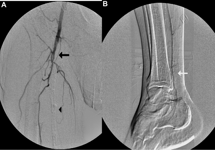 Fig 1