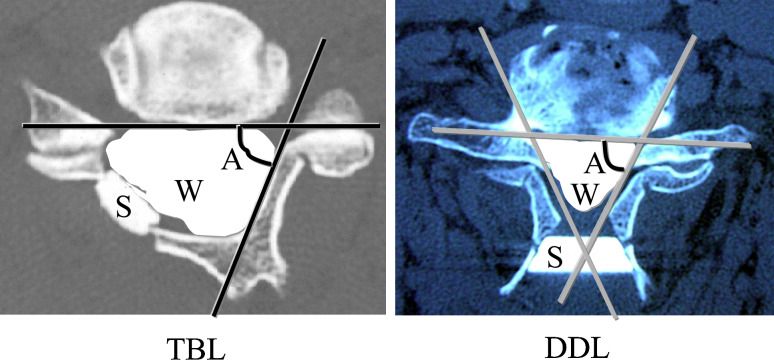 Fig. 1