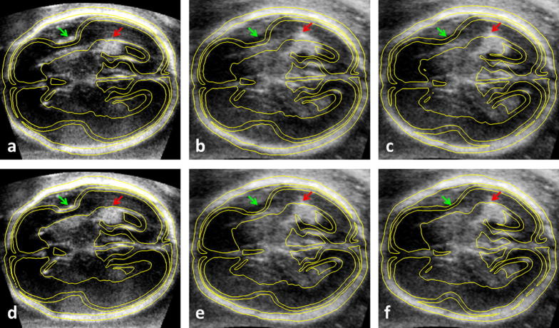 Fig. 8