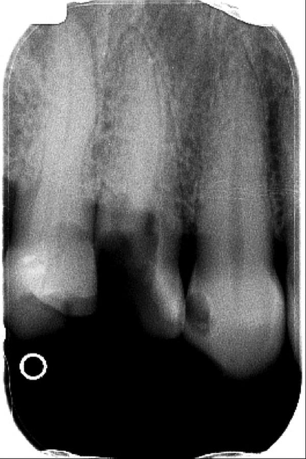 Figure 2