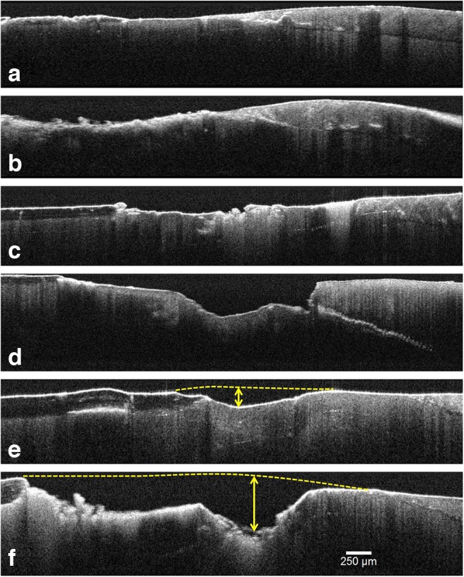 FIG. 4.