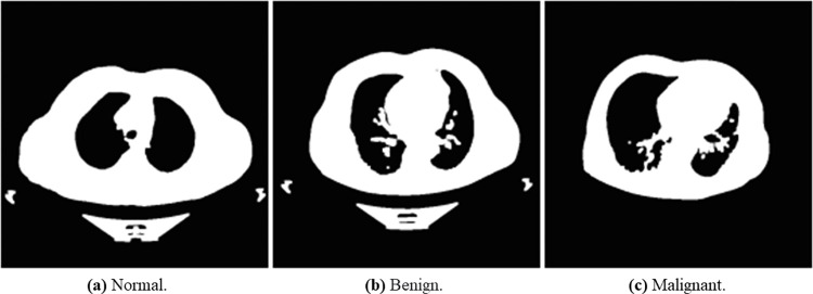 Fig 11