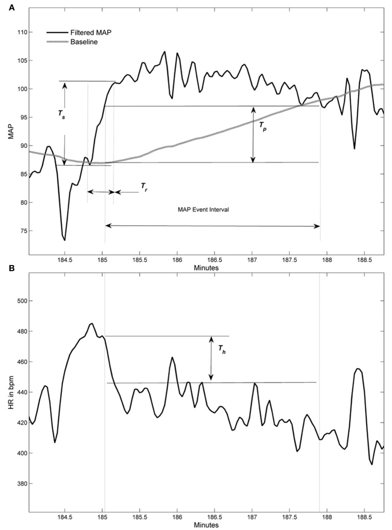 gabapentin for autonomic neuropathy