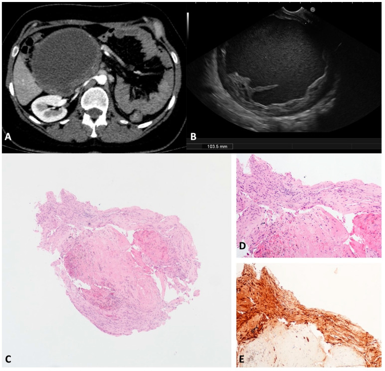 Figure 10