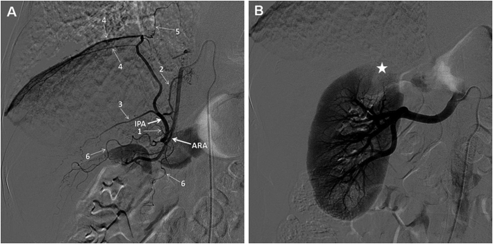 Fig. 3