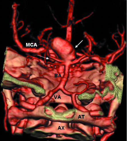 Fig 2