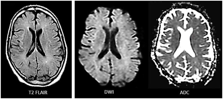 Figure 3.