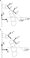 Figure 8. (a) Instead of traditional analyses in the two x-y coordinate systems (Figures 1 through 6), it is proposed that analyses be performed in the two x′-y′ systems in which the y′-axes are more closely aligned (approximately 50° instead of approximately 30° for the incisor and approximately 35° instead of approximately 65° for the premolar) with the direction of desired tooth translations. (b) Analogous to Figure 2a, the assumption that the two y′-axes are collinear yields the y″-axis. Its angulation, 43°, is the average of the 35° and the 50°. (Alternatively, the 43° approximates the line joining the two brackets.) With this approximation, the gross arch distortion (Figure 2b) is avoided, and the traditional widely accepted concepts associated with Figure 2a are more acceptable.