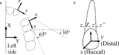 Figure 1. (a) Occlusal view of the simulated clinical case showing the global (X-Y) and the estimated local (x-y) coordinate systems on the maxillary lateral incisor (approximately 30°) and the canine (approximately 65°) brackets. (b) The x-y-z axes of the lateral incisor bracket.