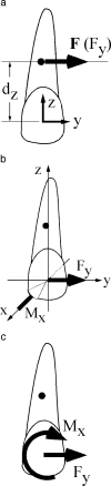 Figure 3. Load systems required for distal translation applied at (a) CRes or at (b and c) the bracket. b and c use, respectively, the RHR and the more (dentally) conventional depictions.