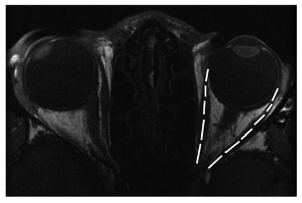 FIG 2