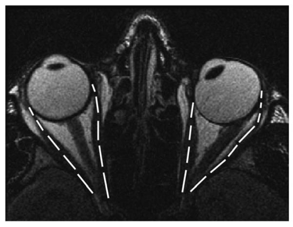 FIG 3