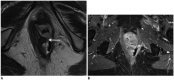 Fig. 11