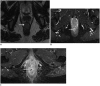 Fig. 12