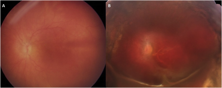 Fig. 4