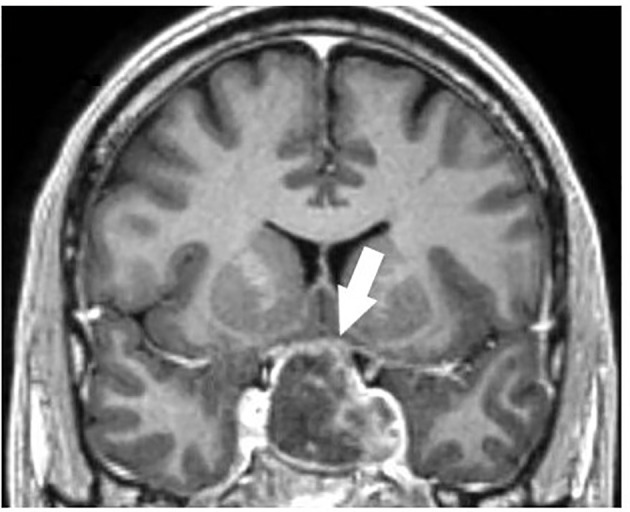 Figure 1