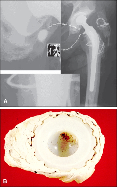 Fig. 2A–B