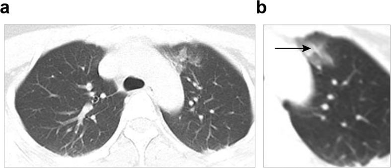 Fig. 1