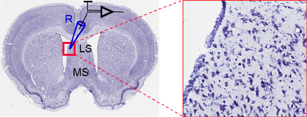 Fig. 1