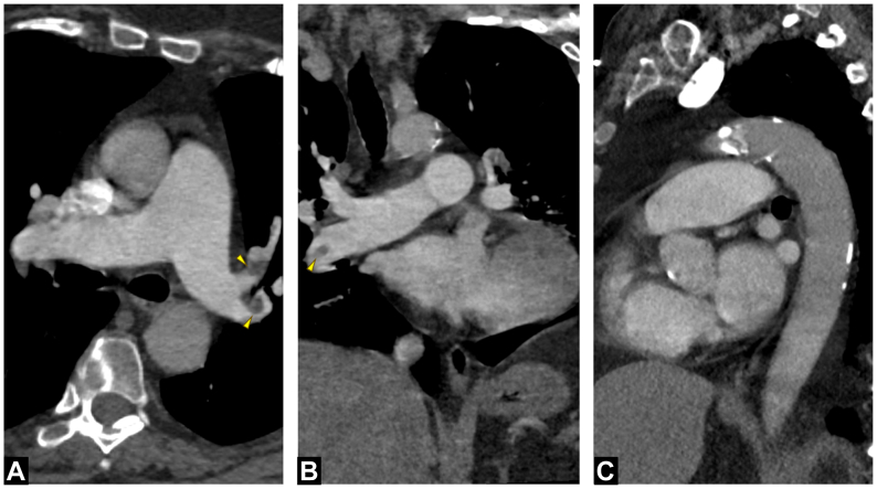 Fig 5