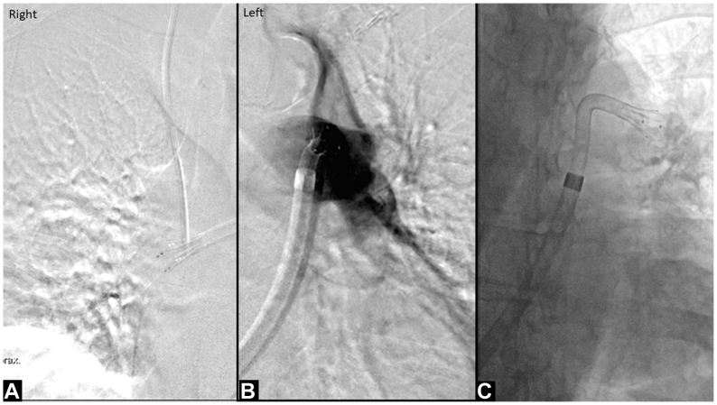 Fig 3
