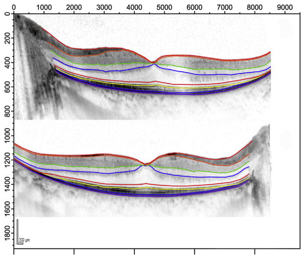 FIGURE 2