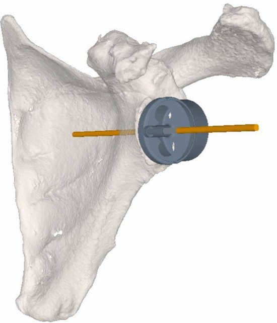 Fig. 1