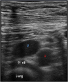 Fig. 3