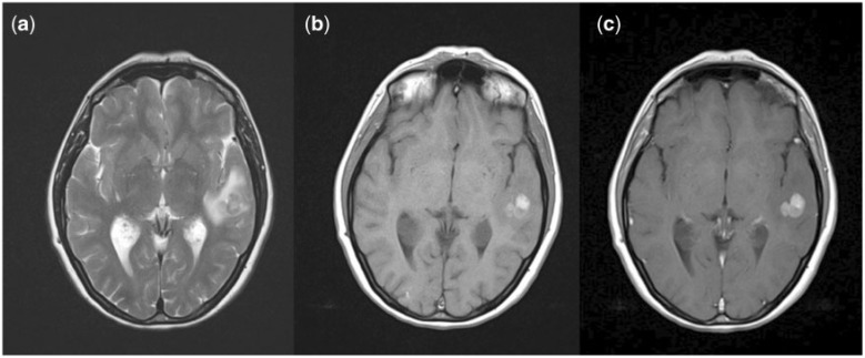 Figure 2