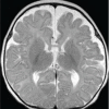 Figure 1b: