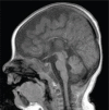 Figure 1a: