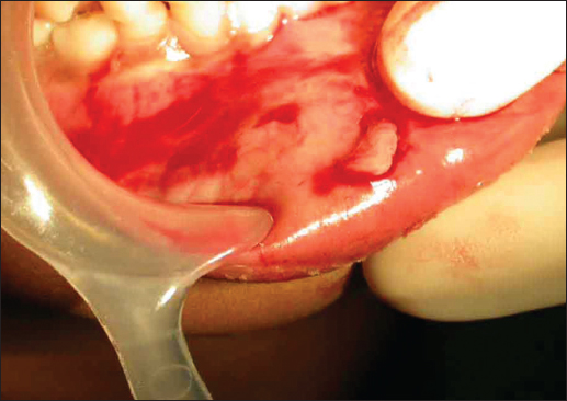 Figure 3: