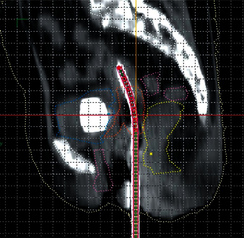 Fig. 1