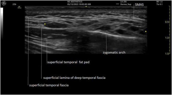 Figure 3.